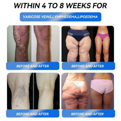 🍈𝑶𝒇𝒇𝒊𝒄𝒊𝒂𝒍 𝑺𝒕𝒐𝒓𝒆 |🧡Enjoy 30% OFF for adding the second one🧡