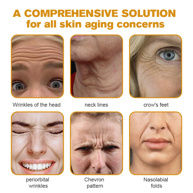 (🌤️Made and Shipped from USA✅) Furzero™ Botox Bee Venom Wrinkle Removal Cream- LAST DAY 70% OFF