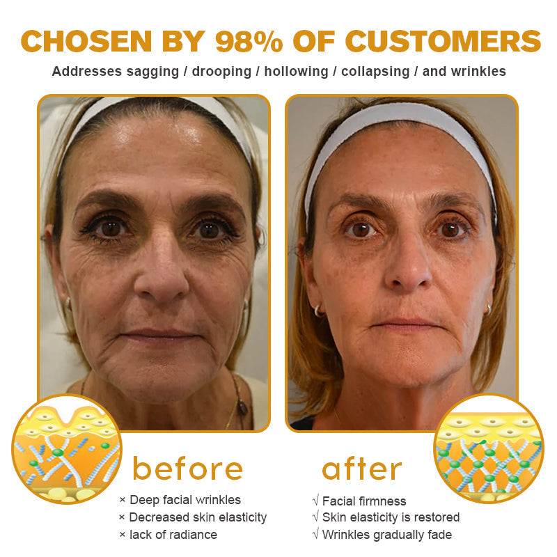 (🌤️Made and Shipped from USA✅) Furzero™ Botox Bee Venom Wrinkle Removal Cream- LAST DAY 70% OFF
