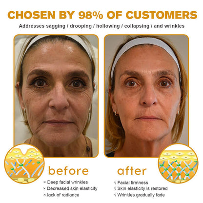 (🌤️Made and Shipped from USA✅) Furzero™ Botox Bee Venom Wrinkle Removal Cream- LAST DAY 70% OFF